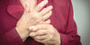 What is Rheumatoid Disease (Rheumatoid Arthritis)? Symptoms and treatments - Grace & Able